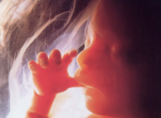 73 million abortions per year are considered a ‘right’… UNFPA report